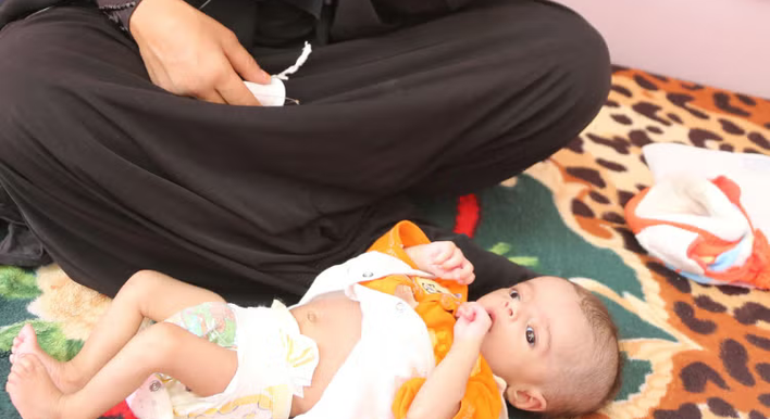 Pregnancy, poverty and the weight of hunger for child brides in Yemen